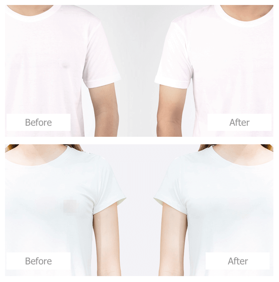 Nipple Cover Band 48mm 104 PCS 