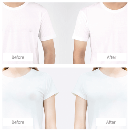 Nipple Cover Band 48mm 104 PCS 