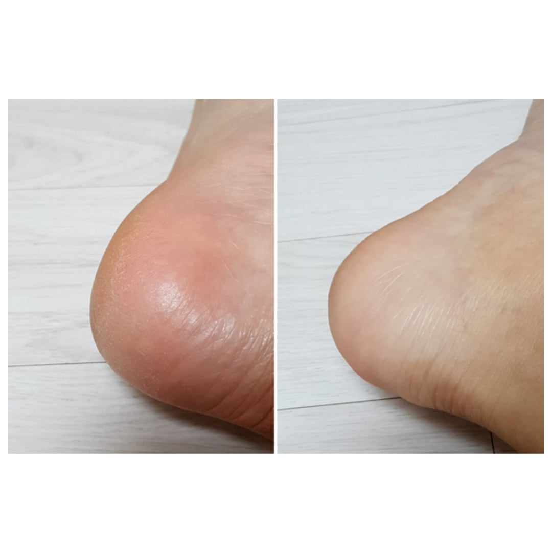 rorobee soft peel off foot pack